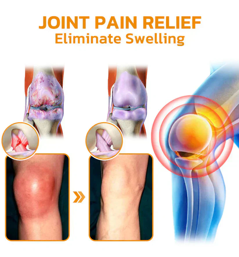Jhati® Bee Venom Instant Ultra Strength Pain Relief Therapy Cream🔥67% OFF today!