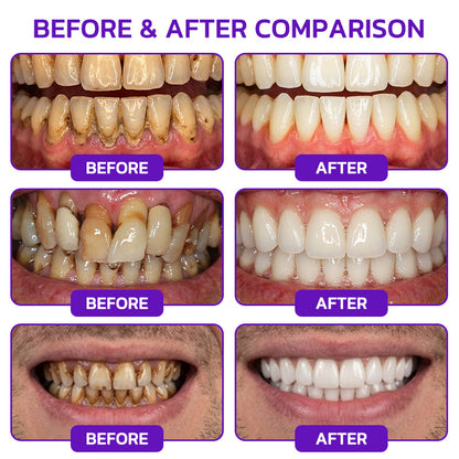 🦷Rolimey® VioCore Bee Venom Gingivitis & Periodontitis Treatment Toothpaste