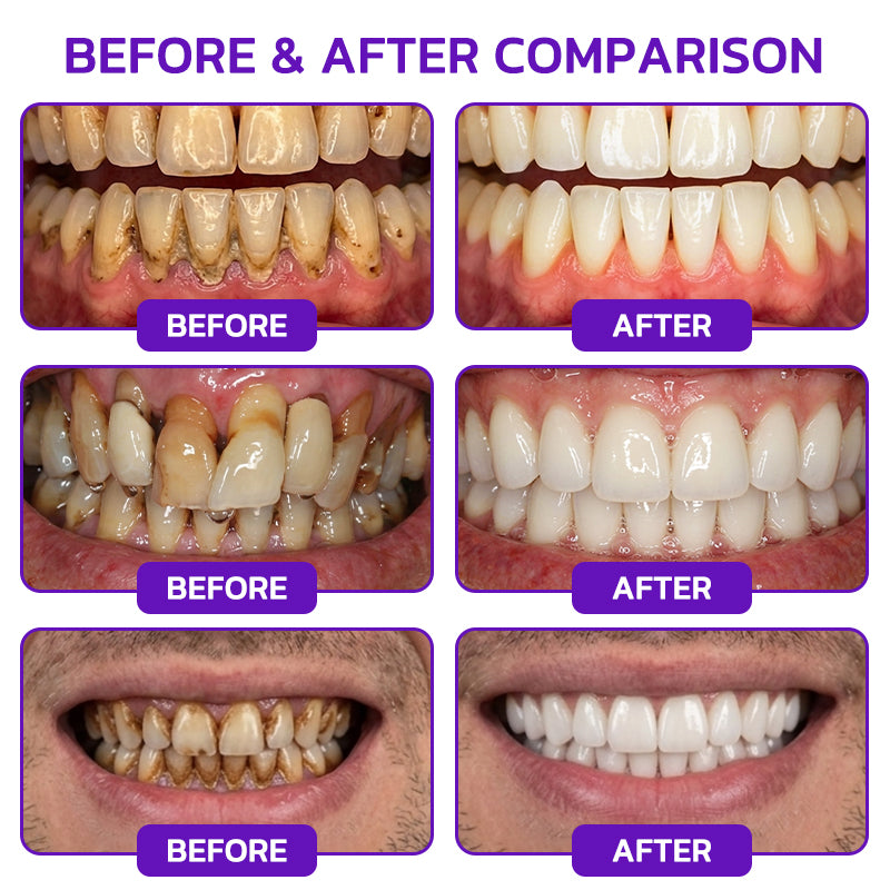 🦷Rolimey® VioCore Bee Venom Gingivitis & Periodontitis Treatment Toothpaste