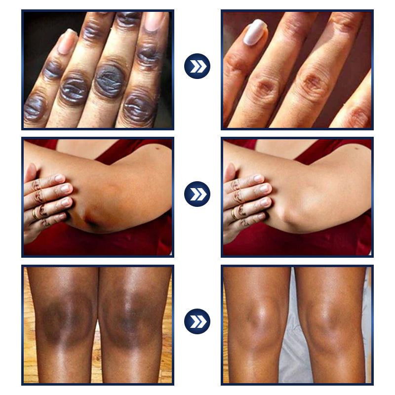 Jhati® Advanced Pigment Rescue Serum