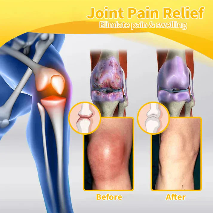 🇺🇸Official Store: flysmus® Bee-Venom Pain-Relief Bone Healing Cream👨‍⚕️FDA Certified