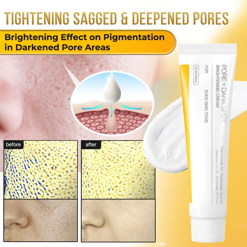 Jhati® MicroNeedle & Melazero V2 Dark Spot Brightening Cream