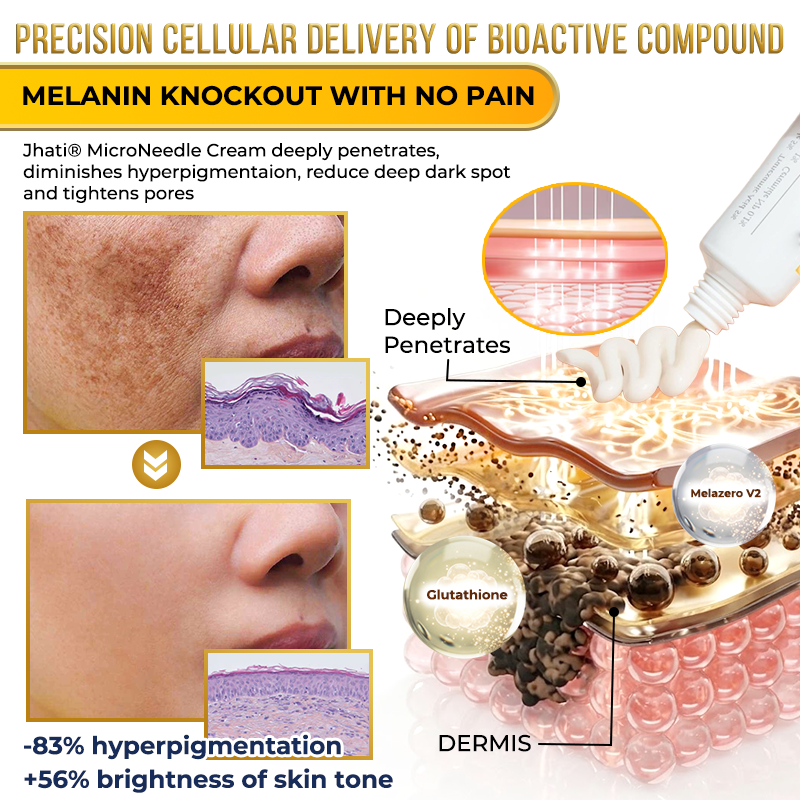 Jhati® MicroNeedle & Melazero V2 Dark Spot Brightening Cream