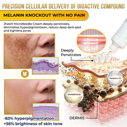 Jhati® MicroNeedle & Melazero V2 Dark Spot Brightening Cream