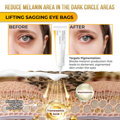 Jhati® MicroNeedle & Melazero V2 Dark Spot Brightening Cream
