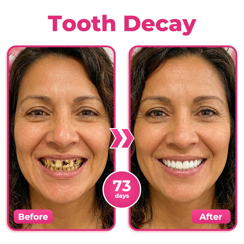 Rolimey® Thismile NH-10 Enamel & Gum Advanced Therapy Toothpaste Serum