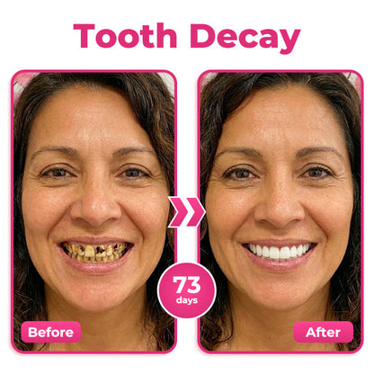 Rolimey® Thismile NH-10 Enamel & Gum Advanced Therapy Toothpaste Serum