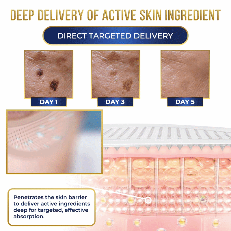 Jhati® MicroNeedle Liposome Glutathione Melanin Removal Patches