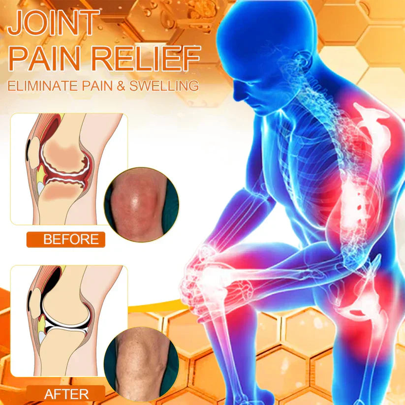 Jhati® Bee Venom Instant Ultra Strength Pain Relief Therapy Cream🔥67% OFF today!