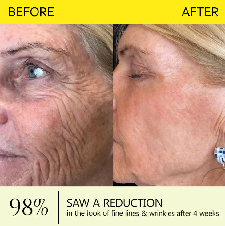 Last Day 70%OFF🥇Botox & Retinol Shot - Eraser for Deep Wrinkles, Sagging Jowls & Puffy Eyes
