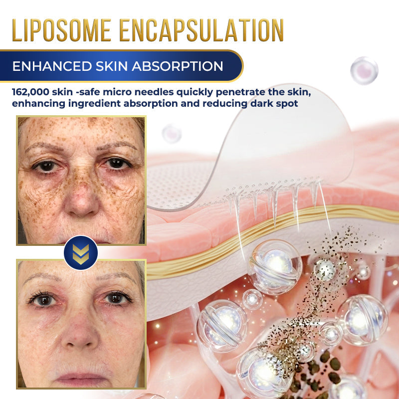 Jhati® MicroNeedle Liposome Glutathione Melanin Removal Patches