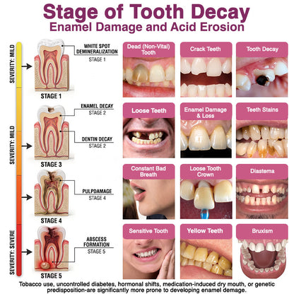 🇺🇸Rolimey® DenPerm Cavity-Repair Natural Enamel Filling Gel