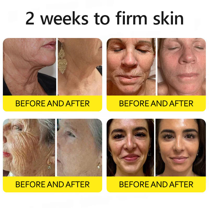 Last Day 70%OFF🥇Botox & Retinol Shot - Eraser for Deep Wrinkles, Sagging Jowls & Puffy Eyes