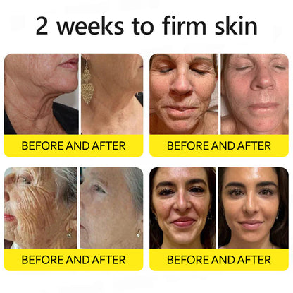 Last Day 70%OFF🥇Botox & Retinol Shot - Eraser for Deep Wrinkles, Sagging Jowls & Puffy Eyes