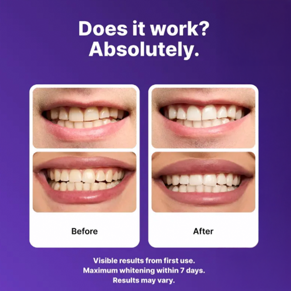 Jhati® COREDENTA Purple Non Sensitive Teeth Whitening Strips