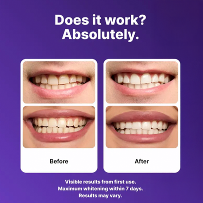Jhati® COREDENTA Purple Non Sensitive Teeth Whitening Strips