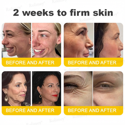 ⭐️Wrinkle-Lift⬆️ Botox & Vita A Retinol Shot Tightening cream
