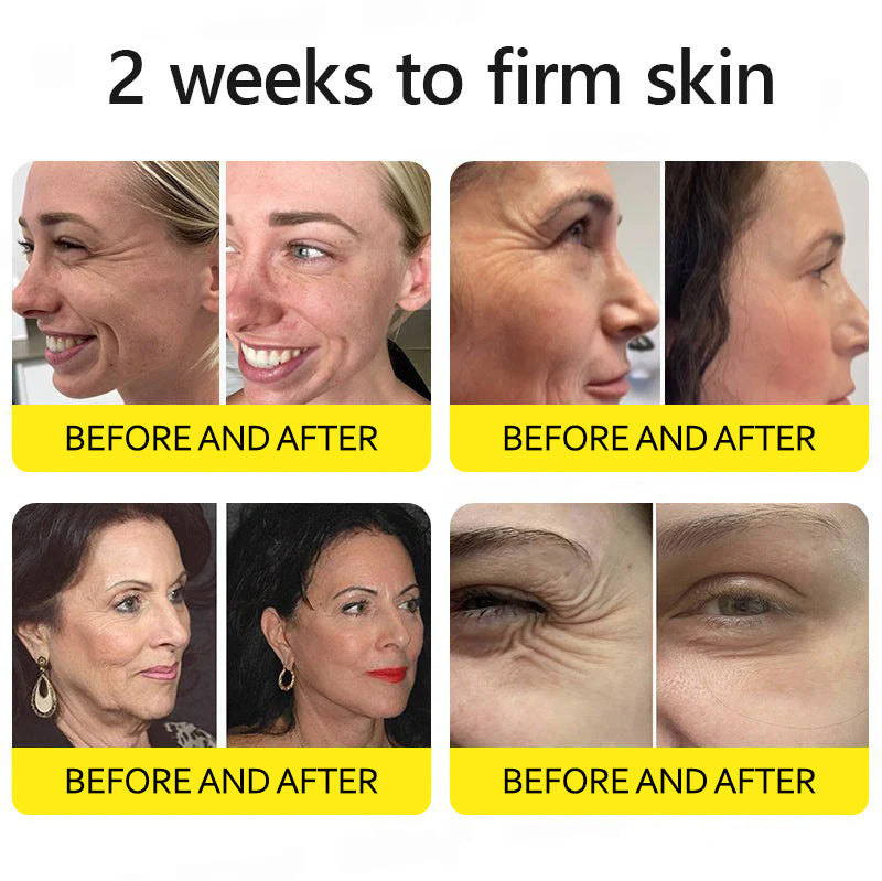 Last Day 70%OFF🥇Botox & Retinol Shot - Eraser for Deep Wrinkles, Sagging Jowls & Puffy Eyes