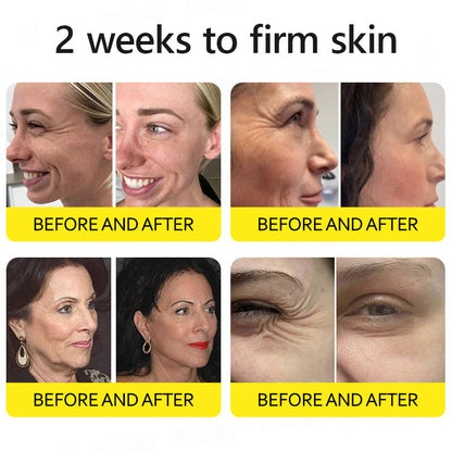Last Day 70%OFF🥇Botox & Retinol Shot - Eraser for Deep Wrinkles, Sagging Jowls & Puffy Eyes