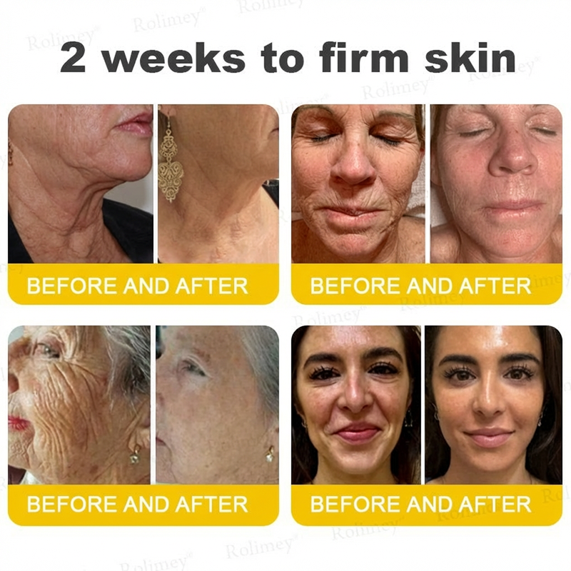 ⭐️Wrinkle-Lift⬆️ Botox & Vita A Retinol Shot Tightening cream