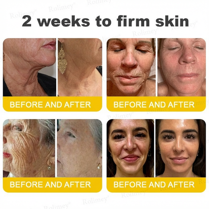 ⭐️Wrinkle-Lift⬆️ Botox & Vita A Retinol Shot Tightening cream