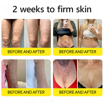 Last Day 70%OFF🥇Botox & Retinol Shot - Eraser for Deep Wrinkles, Sagging Jowls & Puffy Eyes