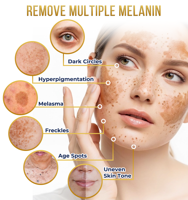 Jhati® MicroNeedle & Melazero V2 Dark Spot Brightening Cream