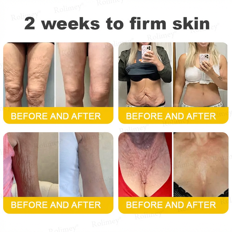 ⭐️Wrinkle-Lift⬆️ Botox & Vita A Retinol Shot Tightening cream