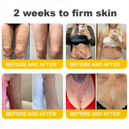 ⭐️Wrinkle-Lift⬆️ Botox & Vita A Retinol Shot Tightening cream