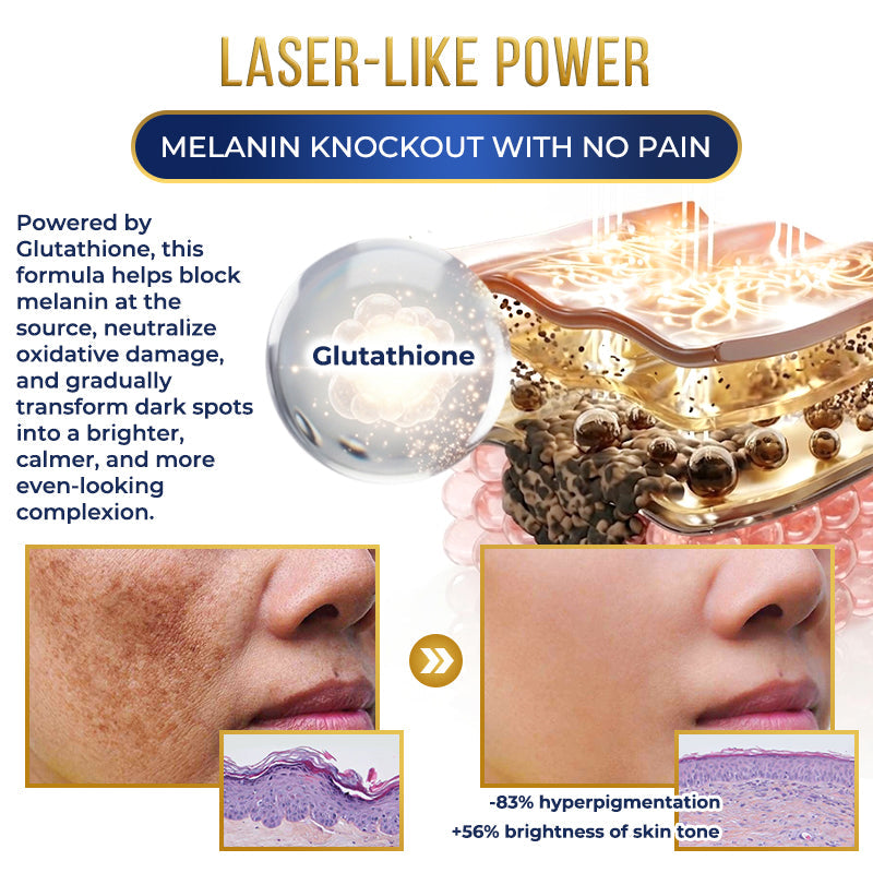 Jhati® MicroNeedle Liposome Glutathione Melanin Removal Patches