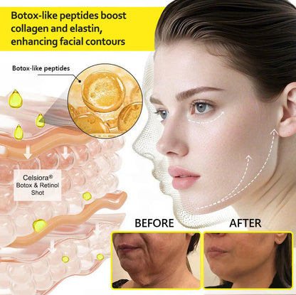 Last Day 70%OFF🥇Botox & Retinol Shot - Eraser for Deep Wrinkles, Sagging Jowls & Puffy Eyes