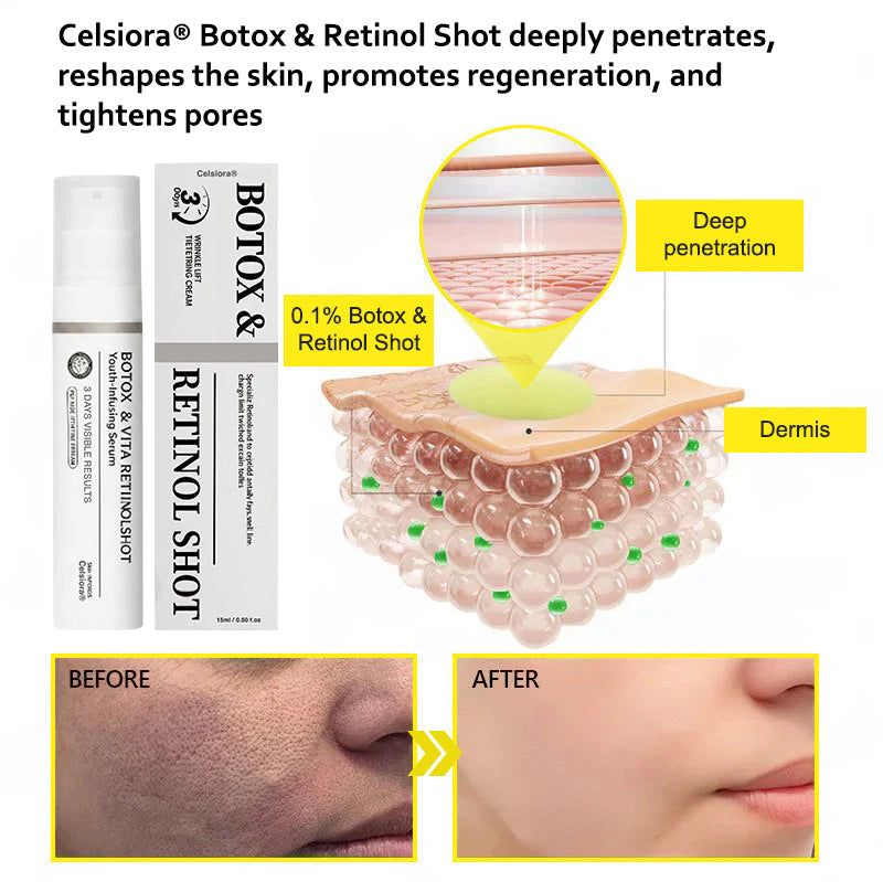 Last Day 70%OFF🥇Botox & Retinol Shot - Eraser for Deep Wrinkles, Sagging Jowls & Puffy Eyes
