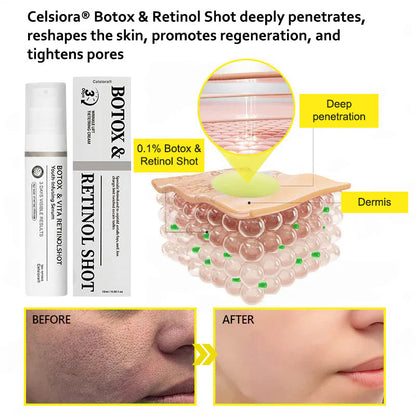 Last Day 70%OFF🥇Botox & Retinol Shot - Eraser for Deep Wrinkles, Sagging Jowls & Puffy Eyes