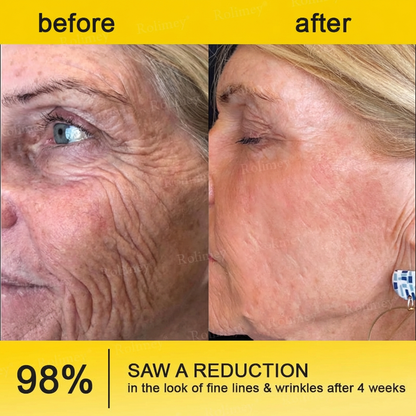 ⭐️Wrinkle-Lift⬆️ Botox & Vita A Retinol Shot Tightening cream
