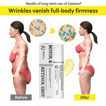 Last Day 70%OFF🥇Botox & Retinol Shot - Eraser for Deep Wrinkles, Sagging Jowls & Puffy Eyes