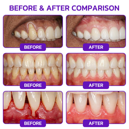 ⭐️Rolimey® VioCore Bee Venom Gingivitis & Periodontitis Treatment Toothpaste