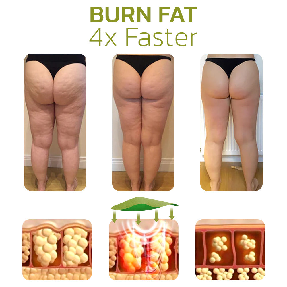 Jhati® Cellulite Reduction Patches