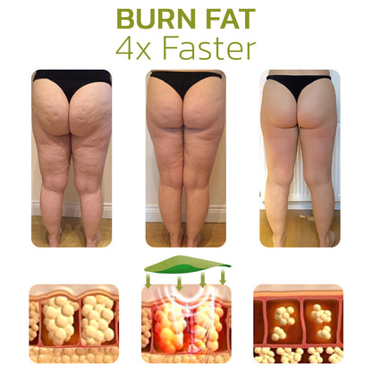 Jhati® Cellulite Reduction Patches