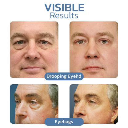 Jhati® Awaken Peptide Lifting Eye Gel