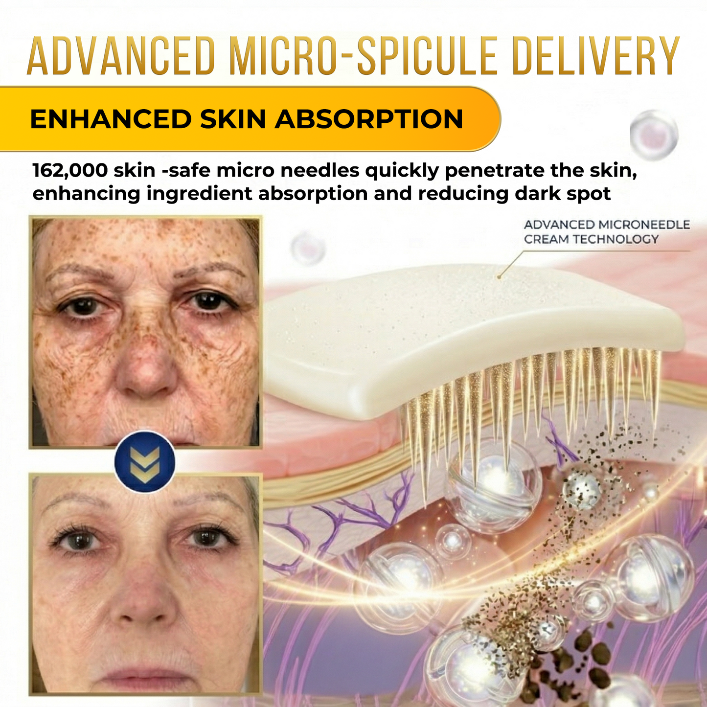 Jhati® MicroNeedle & Melazero V2 Dark Spot Brightening Cream