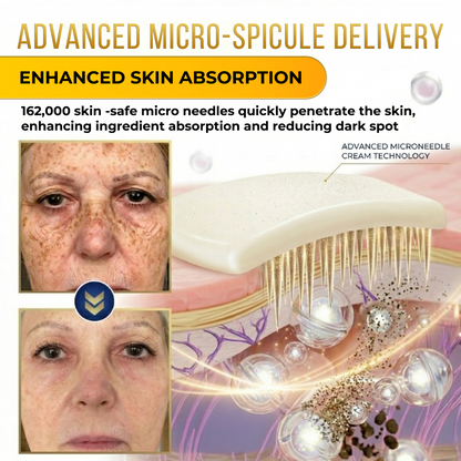 Jhati® MicroNeedle & Melazero V2 Dark Spot Brightening Cream