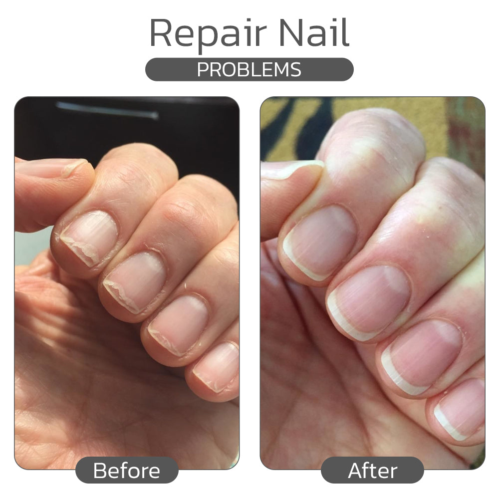 Jhati® Hyaluronic Acid Hand Care Essence