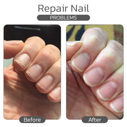 Jhati® Hyaluronic Acid Hand Care Essence