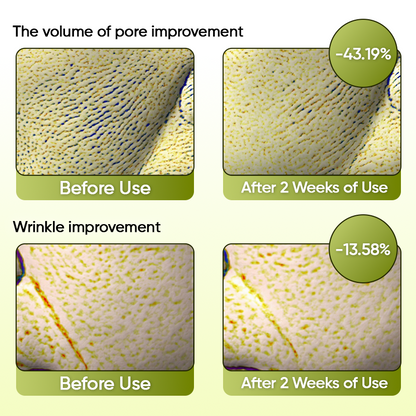Jhati® Wrinkle-Lift Botox & Vita A Retinol Shot