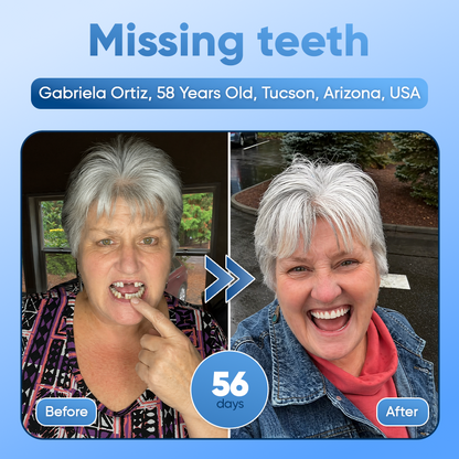 Your Smile🦷Tideglusib Fast‑Dissolving Tooth & Gum Repair Oral Strips✨ (𝟓-𝐢𝐧-𝟏 💎 𝐑𝐞𝐛𝐮𝐢𝐥𝐝 𝐄𝐧𝐚𝐦𝐞𝐥 & 𝐃𝐞𝐧𝐭𝐢𝐧 • 𝐒𝐭𝐫𝐞𝐧𝐠𝐭𝐡𝐞𝐧 𝐆𝐮𝐦𝐬 • 𝐄𝐫𝐚𝐝𝐢𝐜𝐚𝐭𝐞 𝐓𝐚𝐫𝐭𝐚𝐫 & 𝐎𝐝𝐨𝐫 • 𝐖𝐡𝐢𝐭𝐞𝐧𝐢𝐧𝐠 • 𝐒𝐭𝐨𝐩 𝐓𝐨𝐨𝐭𝐡 𝐒𝐞𝐧𝐬𝐢𝐭𝐢𝐯𝐢𝐭𝐲)