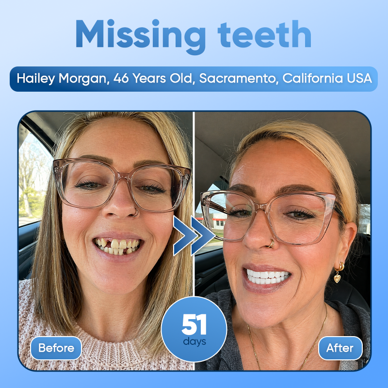 Your Smile🦷Tideglusib Fast‑Dissolving Tooth & Gum Repair Oral Strips✨ (𝟓-𝐢𝐧-𝟏 💎 𝐑𝐞𝐛𝐮𝐢𝐥𝐝 𝐄𝐧𝐚𝐦𝐞𝐥 & 𝐃𝐞𝐧𝐭𝐢𝐧 • 𝐒𝐭𝐫𝐞𝐧𝐠𝐭𝐡𝐞𝐧 𝐆𝐮𝐦𝐬 • 𝐄𝐫𝐚𝐝𝐢𝐜𝐚𝐭𝐞 𝐓𝐚𝐫𝐭𝐚𝐫 & 𝐎𝐝𝐨𝐫 • 𝐖𝐡𝐢𝐭𝐞𝐧𝐢𝐧𝐠 • 𝐒𝐭𝐨𝐩 𝐓𝐨𝐨𝐭𝐡 𝐒𝐞𝐧𝐬𝐢𝐭𝐢𝐯𝐢𝐭𝐲)