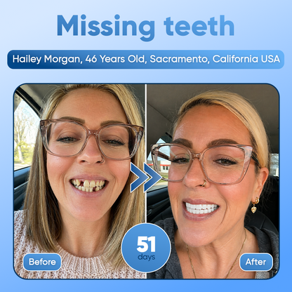 Your Smile🦷Tideglusib Fast‑Dissolving Tooth & Gum Repair Oral Strips✨ (𝟓-𝐢𝐧-𝟏 💎 𝐑𝐞𝐛𝐮𝐢𝐥𝐝 𝐄𝐧𝐚𝐦𝐞𝐥 & 𝐃𝐞𝐧𝐭𝐢𝐧 • 𝐒𝐭𝐫𝐞𝐧𝐠𝐭𝐡𝐞𝐧 𝐆𝐮𝐦𝐬 • 𝐄𝐫𝐚𝐝𝐢𝐜𝐚𝐭𝐞 𝐓𝐚𝐫𝐭𝐚𝐫 & 𝐎𝐝𝐨𝐫 • 𝐖𝐡𝐢𝐭𝐞𝐧𝐢𝐧𝐠 • 𝐒𝐭𝐨𝐩 𝐓𝐨𝐨𝐭𝐡 𝐒𝐞𝐧𝐬𝐢𝐭𝐢𝐯𝐢𝐭𝐲)