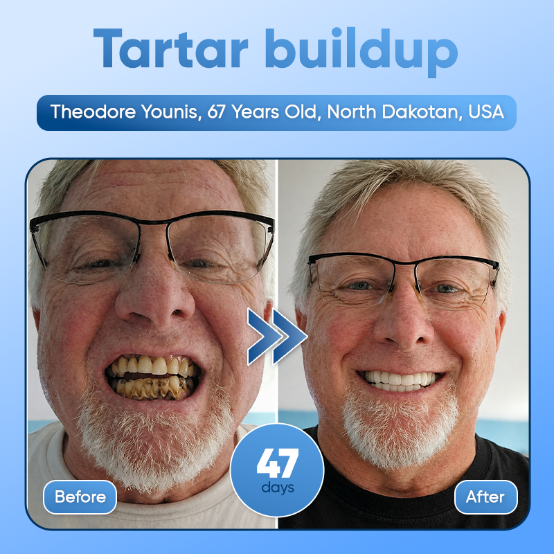 Your Smile😁Tideglusib Fast‑Dissolving Tooth & Gum Repair Oral Strips🦷✨ (𝟓-𝐢𝐧-𝟏 💎 𝐑𝐞𝐛𝐮𝐢𝐥𝐝 𝐄𝐧𝐚𝐦𝐞𝐥 & 𝐃𝐞𝐧𝐭𝐢𝐧 • 𝐒𝐭𝐫𝐞𝐧𝐠𝐭𝐡𝐞𝐧 𝐆𝐮𝐦𝐬 • 𝐄𝐫𝐚𝐝𝐢𝐜𝐚𝐭𝐞 𝐓𝐚𝐫𝐭𝐚𝐫 & 𝐎𝐝𝐨𝐫 • 𝐖𝐡𝐢𝐭𝐞𝐧𝐢𝐧𝐠 • 𝐒𝐭𝐨𝐩 𝐓𝐨𝐨𝐭𝐡 𝐒𝐞𝐧𝐬𝐢𝐭𝐢𝐯𝐢𝐭𝐲)