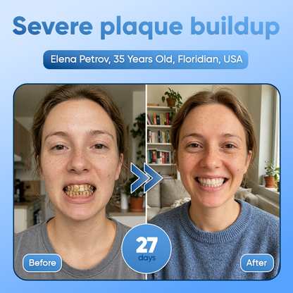 Your Smile🦷Tideglusib Fast‑Dissolving Tooth & Gum Repair Oral Strips✨ (𝟓-𝐢𝐧-𝟏 💎 𝐑𝐞𝐛𝐮𝐢𝐥𝐝 𝐄𝐧𝐚𝐦𝐞𝐥 & 𝐃𝐞𝐧𝐭𝐢𝐧 • 𝐒𝐭𝐫𝐞𝐧𝐠𝐭𝐡𝐞𝐧 𝐆𝐮𝐦𝐬 • 𝐄𝐫𝐚𝐝𝐢𝐜𝐚𝐭𝐞 𝐓𝐚𝐫𝐭𝐚𝐫 & 𝐎𝐝𝐨𝐫 • 𝐖𝐡𝐢𝐭𝐞𝐧𝐢𝐧𝐠 • 𝐒𝐭𝐨𝐩 𝐓𝐨𝐨𝐭𝐡 𝐒𝐞𝐧𝐬𝐢𝐭𝐢𝐯𝐢𝐭𝐲)