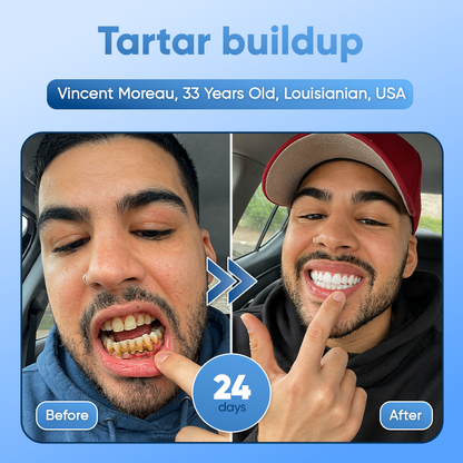 Your Smile🦷Tideglusib Fast‑Dissolving Tooth & Gum Repair Oral Strips✨ (𝟓-𝐢𝐧-𝟏 💎 𝐑𝐞𝐛𝐮𝐢𝐥𝐝 𝐄𝐧𝐚𝐦𝐞𝐥 & 𝐃𝐞𝐧𝐭𝐢𝐧 • 𝐒𝐭𝐫𝐞𝐧𝐠𝐭𝐡𝐞𝐧 𝐆𝐮𝐦𝐬 • 𝐄𝐫𝐚𝐝𝐢𝐜𝐚𝐭𝐞 𝐓𝐚𝐫𝐭𝐚𝐫 & 𝐎𝐝𝐨𝐫 • 𝐖𝐡𝐢𝐭𝐞𝐧𝐢𝐧𝐠 • 𝐒𝐭𝐨𝐩 𝐓𝐨𝐨𝐭𝐡 𝐒𝐞𝐧𝐬𝐢𝐭𝐢𝐯𝐢𝐭𝐲)